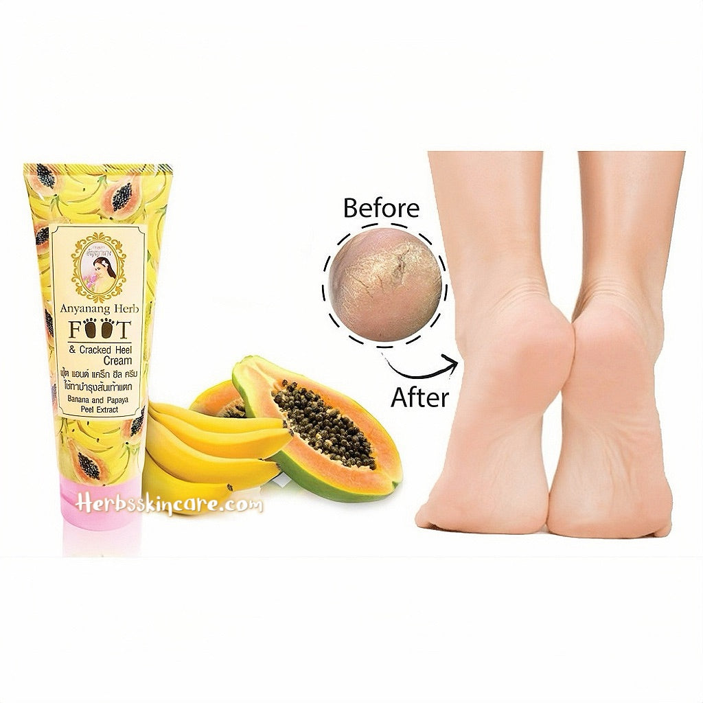 ANYANANG HERB FOOT & CRACKED HEEL CREAM 200 G.