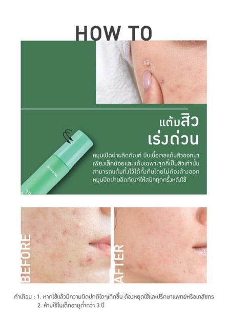BABY BRIGHT CLEAR ACNE GEL 15 G.