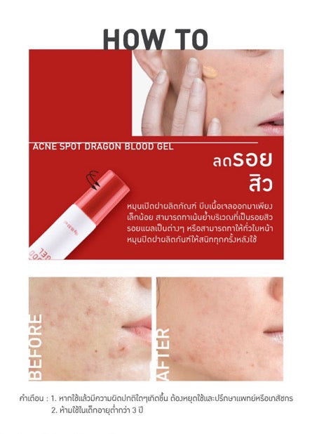 BABY BRIGHT ACNE SPOT DRAGON BLOOD GEL 15 G.