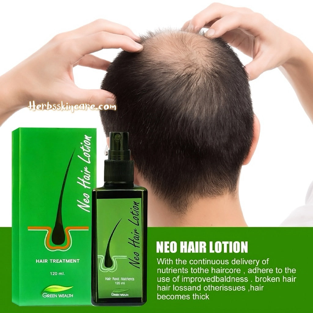 NEO HAIR LOTION 120 ML. (NATURAL HAIR REGROWTH)